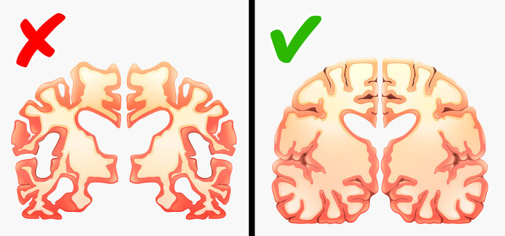 Bệnh Alzheimer: Đây là căn bệnh phổ biến nhất của chứng mất trí nhớ, xuất hiện ở phụ nữ nhiều hơn nam giới. Chưa có biện pháp cụ thể điều trị nhưng bạn có thể giảm nguy cơ mắc bệnh bằng lối sống lành mạnh.