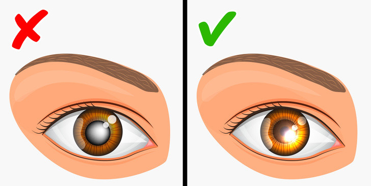 Tăng nhãn áp: Phụ nữ là đối tượng dễ mắc tăng nhãn áp hơn nam giới và bệnh này cũng dễ di truyền từ mẹ sang con. Để phòng ngừa bệnh, mỗi người cần kiểm tra sức khỏe định kỳ cũng như luyện tập thể thao, tăng sức đề kháng.