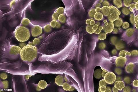 Ky bi loai nam hut duoc vang trong dat, ai vo duoc giau to