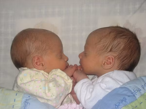 Một trường hợp kỳ lạ cũng từng được ghi nhận khi người mẹ mang song thai nhưng hai em bé lại cách nhau 1 tuần tuổi. Chị Angie Cromar, 34 tuổi phát hiện mình mang song thai nhưng thực ra lại không phải là song thai. Vợ chồng chị rất bất ngờ xen lẫn hào hứng khi bác sĩ cho biết trường hợp này vô cùng hiếm gặp với xác suất chỉ 1/5 triệu người.