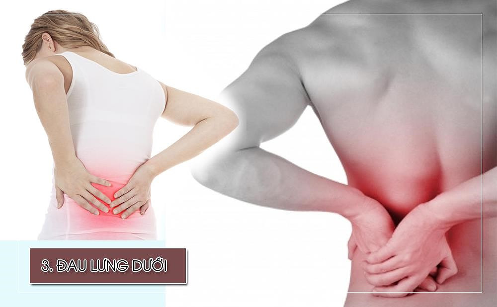 Đau lưng dưới là một dấu hiệu nghiêm trọng bạn không nên bỏ qua. Khi lưu lượng máu đến lưng dưới bị giảm, các đĩa đệm giữa các đốt sống trở nên mỏng hơn. Điều này dẫn đến các dây thần kinh bị chèn ép gây đau đớn. Theo một nghiên cứu, 10% người dân ở các nước phát triển đã bị tắc động mạch chủ khi họ 20 tuổi.