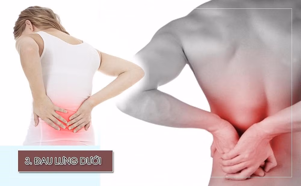 Đau lưng dưới là một dấu hiệu nghiêm trọng bạn không nên bỏ qua. Khi lưu lượng máu đến lưng dưới bị giảm, các đĩa đệm giữa các đốt sống trở nên mỏng hơn. Điều này dẫn đến các dây thần kinh bị chèn ép gây đau đớn. Theo một nghiên cứu, 10% người dân ở các nước phát triển đã bị tắc động mạch chủ khi họ 20 tuổi.