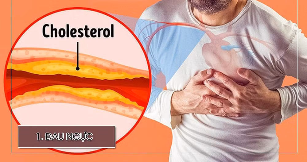 Đau ngực (hay đau thắt ngực) là kết quả của việc giảm lưu lượng máu đến tim. Dấu hiêụ đau ngực là bị nghẹt, tê, hoặc tăng áp lực cơ ngực. Mọi người thường không gặp phải các dấu hiệu này khi nghỉ ngơi vì nó xảy ra khi có tác động bởi hoạt động thể chất hoặc thay đổi cảm xúc. Trong một số trường hợp, vật làm mạch bị tắc sẽ khiến cơn đau như thắt lại và nó báo hiệu rằng một người đang bị đau tim.