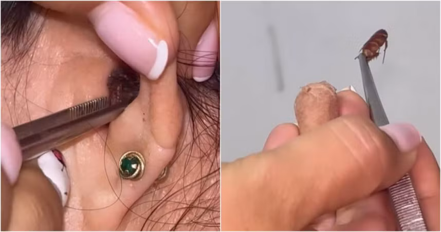 Dau am i trong tai, soc nang phat hien “quai thu” an nau