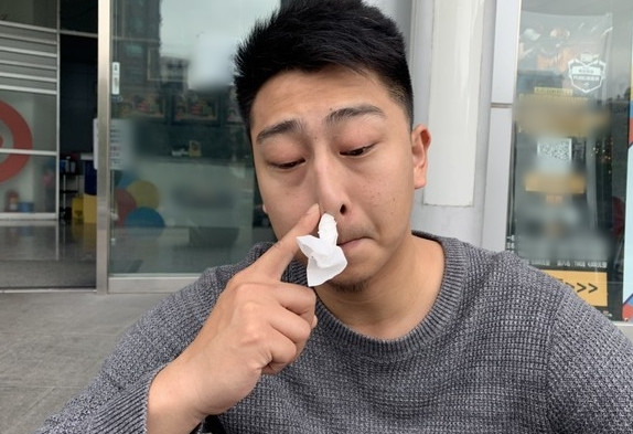 Nghet mui 3 nam, chang trai khien bac si suyt non vi dieu nay