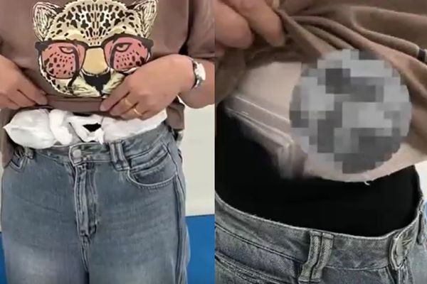 Dang di la lung, nguoi phu nu bi bat...lo bung day ran ret