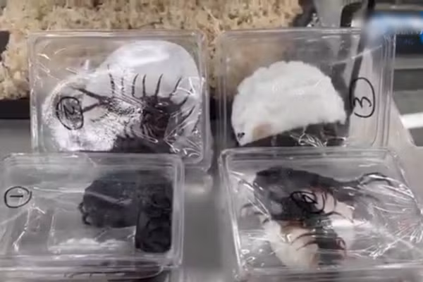 Dang di la lung, nguoi phu nu bi bat...lo bung day ran ret-Hinh-3