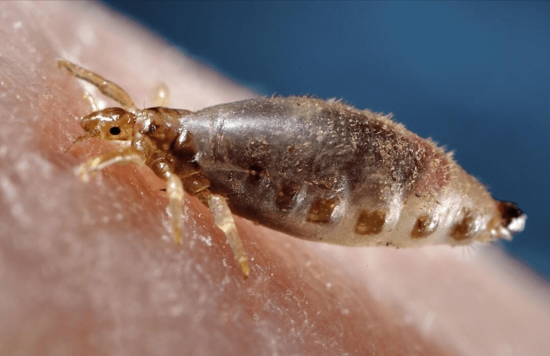 Theo tìm hiểu, chấy là loài côn trùng nhỏ sống trên da đầu con người và hút máu người. Nhiễm chấy được gọi là Peesulosis capitis và chấy có thể lây lan từ đầu người này sang người khác.