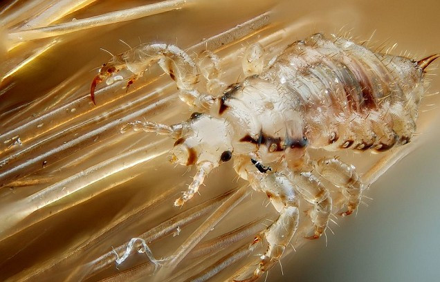 "Những con chấy này đã ở trên đầu cô ấy trong nhiều năm, chỉ vừa vạch nhẹ tóc ra đã có thể thấy rõ hàng trăm con chấy đang bò bên trong", nữ bác sĩ nói.