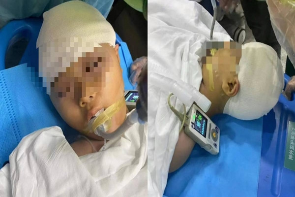 Thay giao danh nu sinh 9 tuoi chan thuong so nao gay phan no