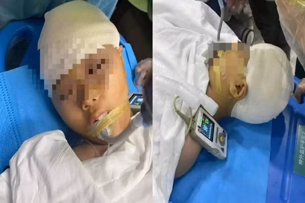 Thay giao danh nu sinh 9 tuoi chan thuong so nao gay phan no