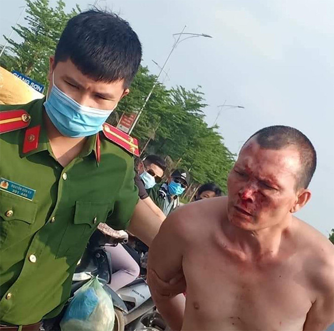 Canh cao cong an dung goi dien thoai, ke dan vat lon voi cuop: Co thuyet phuc?-Hinh-2