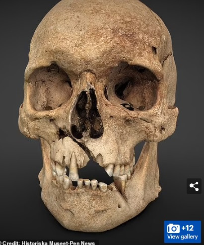 Theo chuyên gia Moraes, những vật đánh dấu này chỉ ra ranh giới da ở một số khu vực trên gương mặt. Để bổ sung dữ liệu, ông Moraes và đồng nghiệp nhập một bản chụp cắt lớp từ tình nguyện viên và làm biến dạng xương cũng như mô mềm trên bản chụp để phù hợp với gương mặt cần dựng.