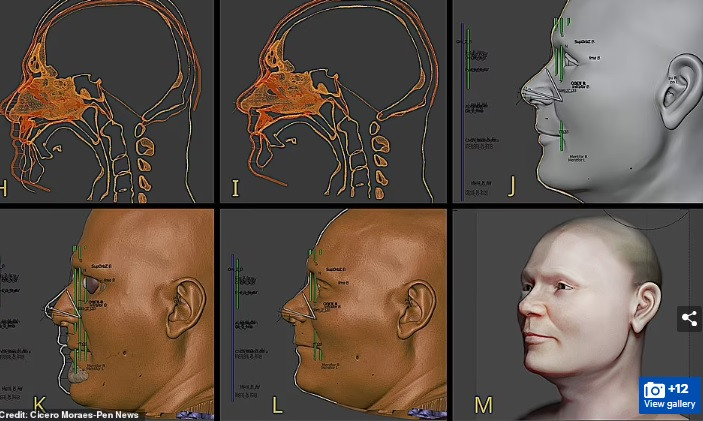 Theo đó, gương mặt của người chiến binh có một vết thương lớn do rìu gây ra. Các chuyên gia suy đoán cú bổ bằng rìu này có thể gây ra vết thương chí mạng cho chiến binh trên. Tuy nhiên, hiện các chuyên gia chưa thể khẳng định vết thương do rìu bổ vào mặt là nguyên nhân trực tiếp dẫn đến cái chết của người chiến binh.