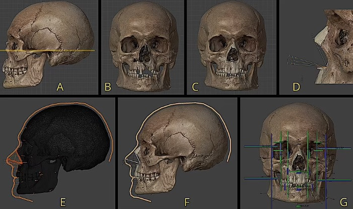 Tiếp đến, chuyên gia Moraes tiến hành bổ sung các đặc điểm về mũi, miệng, tóc dựa trên số lượng thống kê. Kết quả cuối cùng cho thấy gương mặt của người chiến binh này vào thời điểm qua đời.