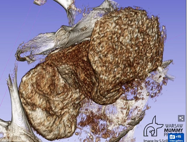 Tuy nhiên, kết quả nghiên cứu công bố vào năm 2021 cho thấy xác ướp khoảng 2.000 tuổi này thuộc về một phụ nữ mang thai. Thai nhi được ướp xác cùng mẹ. Theo đó, đây là xác ướp mang thai đầu tiên trên thế giới được tìm thấy từ trước đến nay.