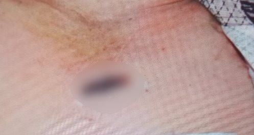 Vụ mở quan tài khám nghiệm tử thi, nghi phạm là con nạn nhân Vu mo quan tai kham nghiem tu thi, nghi pham la con nan nhan