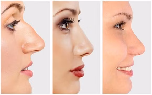 Nhin 8 bo phan nay co the noi len nhieu dieu ve tinh cach