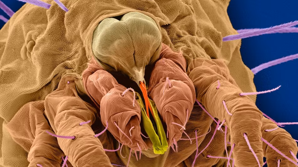 Nhiều người cảm thấy rợn tóc gáy khi nhìn vào ảnh chụp qua kính hiển vi loài ký sinh sống trên mặt thớt này. Trong thực tế, nấm, vi khuẩn dạng sợi, và các vi khuẩn khác sinh sống rất nhiều trong căn bếp được cho là sạch sẽ của bạn. (Nguồn Sina)