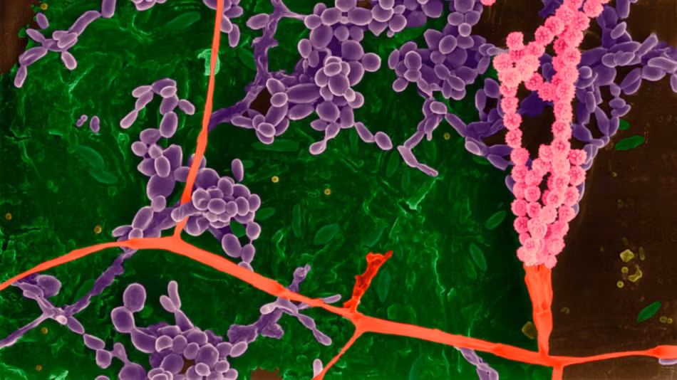 Sau khi được sử dụng một thời gian dài, những dụng cụ nhà bếp của bạn có thể sẽ bị các loại vi khuẩn tấn công. Chúng bám trên những dụng cụ đó và sinh sản nhanh chóng một cách đáng sợ. (Nguồn Sina)