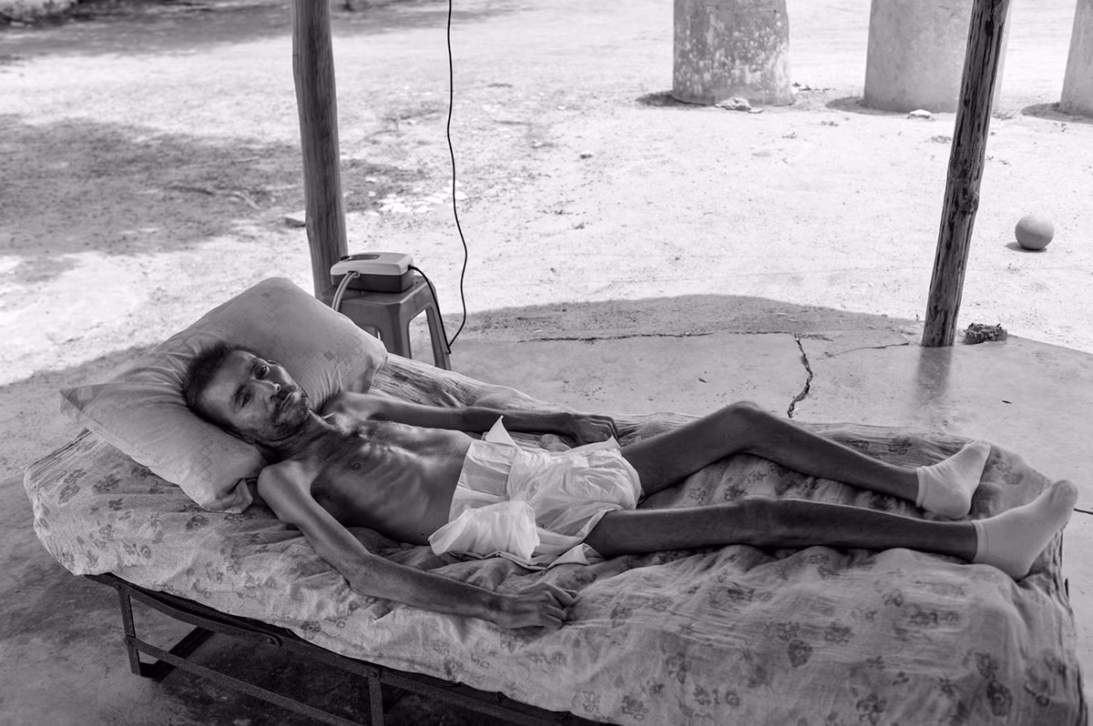 Người đàn ông trong tình trạng suy dinh dưỡng nằm trên giường ở vùng nông thôn quanh Maracaibo. Anh không thể tự đi lại được và nghèo túng sau một vụ tai nạn xe ở chỗ làm.