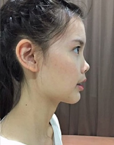 Tuy nhiên, thời gian làm phẫu thuật thẩm mỹ chỉ 14 ngày mà nhiều trang địa phương tiết lộ vẫn khiến nhiều người hoài nghi.