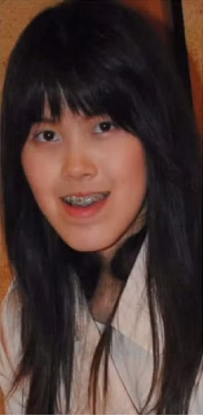  Thiếu nữ mặt lệch nhìn từ phía chính diện không quá xấu xí, nhưng nếu nhìn từ hai bên, sẽ thấy ngay đặc điểm khá dị hợm ở phần hàm dưới và cằm.