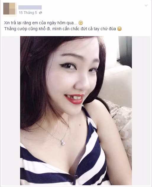 Mai Ánh được biết đến với nickname A.A trong câu chuyện "cắn cướp mất răng" từng mang lại nhiều tiếng cười, sự tò mò và cả những cuộc tranh cãi cho dân mạng Việt.