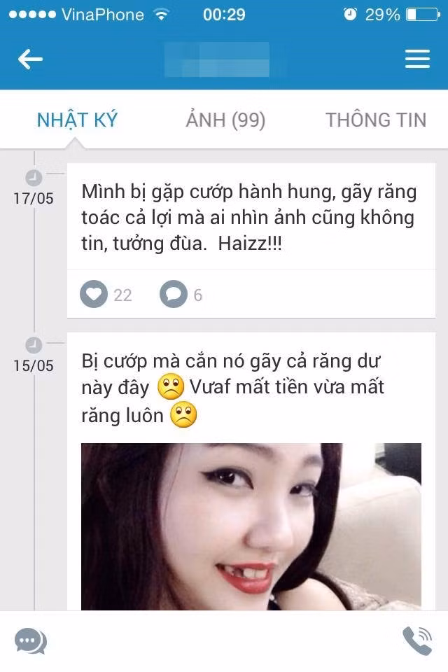 9X xinh đẹp kể câu chuyện cô gặp cướp trên đường, bị lấy mất tiền, túi xách nhưng cô vẫn cố phản kháng, cắn kẻ cắp đến mức gãy răng. Hình ảnh cô gái xinh đẹp bị gãy răng nanh chia sẻ trên mạng khiến các bạn trẻ không thể nhịn cười.