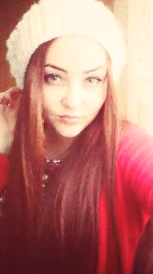 Theo Mirror, Ursu bị bỏng hơn 50% cơ thể, bị sốc và hệ thần kinh bị phá hủy. Theo các bác sĩ, dù Ursu không chạm vào dây điện nhưng do cô giơ chân lên cao lúc chụp ảnh nên nguồn điện gần đó đã phóng vào người cô gây nên thảm cảnh.