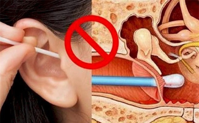 Nguoi phu nu suyt bi diec vi thoi quen nhieu nguoi Viet mac phai-Hinh-2