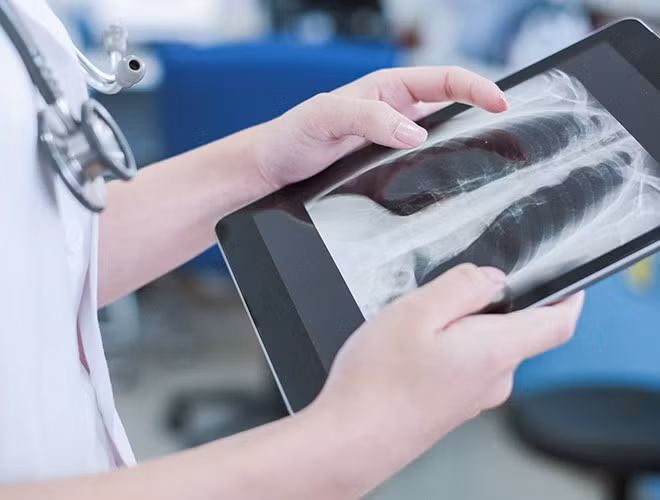 Các nghiên cứu được công bố hồi tháng 5 vừa qua cho thấy, hình ảnh chụp phổi và mẫu máu của các bệnh nhân đã chỉ ra rằng virus mới đã xuất hiện ở Pháp vài tuần trước khi nó được báo cáo chính thức vào ngày 24/1.