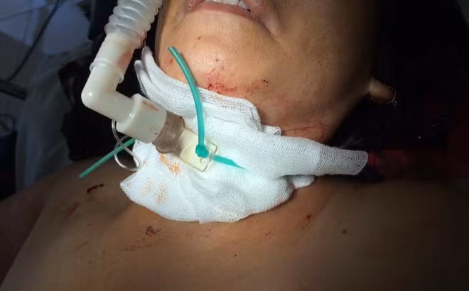 Chu tiem cat toc o Thai Nguyen bi cua co: Chan dung nghi pham 16 tuoi