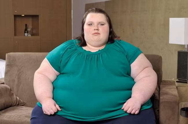 Theo khoa học hiện đại, bệnh béo phì có liên quan mật thiết đến chức năng của thận.