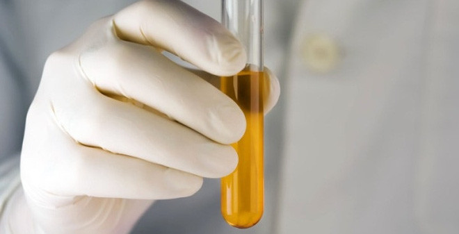 Đường niệu đạo xuất hiện vi khuẩn, đường tiết niệu bị nhiễm trùng như nhiễm trùng đường tiểu, viêm tiền liệt tuyết... đều có thể gây ra hiện tượng nước tiểu có bọt, hoặc tiểu rắt, tiểu són, mót tiểu.