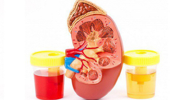 Lý do khác: Khi đi tiểu đứng quá cao hoặc tiểu quá mạnh khiến áp suất mạnh trên bề mặt nước lớn tạo nên lớp bọt. Ngoài ra, bồn cầu có thể có dính chất tẩy rửa cũng là lý do tạo nên bọt khí trong nước tiểu.