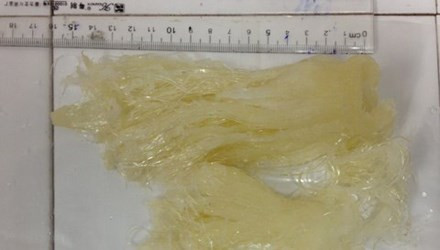 Chi cả triệu đồng mua vi cá mập tẩm bổ song không ít người nếm trái đắng "tiền mất, tật mang" vì loại thực phẩm bổ dưỡng này bị làm giả. Cục Quản lý Chất lượng Nông lâm sản và Thủy sản - Nafiqad (Bộ NN&amp;PTNT) đã từng phát hiện vi cá mập giả mạo, khi đốt có mùi khét của nhựa dẻo.