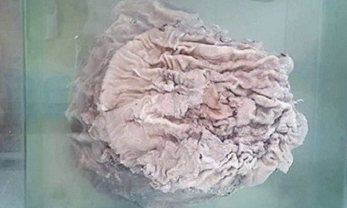 Một người dân ở Trường Xuân (Trung Quốc) từng tìm được cây nấm linh chi Thái Tuế nặng gần 25kg. Cây nấm này đã được một nhà sưu tầm trả giá gần 8.000 USD song anh không bán.