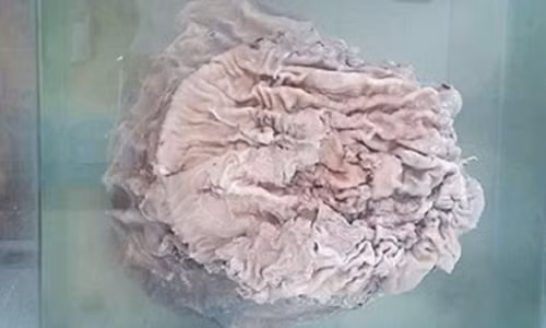 Một người dân ở Trường Xuân (Trung Quốc) từng tìm được cây nấm linh chi Thái Tuế nặng gần 25kg. Cây nấm này đã được một nhà sưu tầm trả giá gần 8.000 USD song anh không bán.