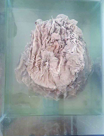 Từ xa xưa loại nấm linh chi này còn được xếp vào hàng siêu phẩm, được dùng cho vua chúa thời xưa để kéo dài tuổi thọ, tẩm bổ sức khỏe. Chúng vô cùng quý hiếm, vì thế giá mua được nấm linh chi Thái Tuế không hề dễ chịu.