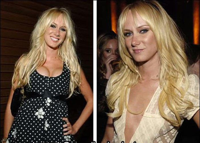 Kimberly Stewart cũng như nhiều người đẹp khác gặp rắc rối với miếng độn ngực quá khổ khi những cơn đau lưng kéo dài. Cô đã phải tháo túi ngực để không bị đau đớn thường xuyên.