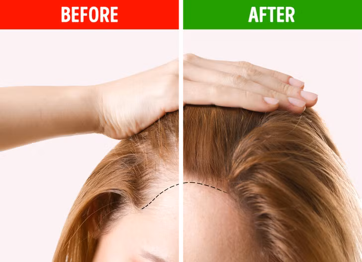 Ăn nhiều rau, trái cây và protein: Nếu bạn muốn tóc chắc khỏe và mọc dày, hãy ăn nhiều rau xanh và trái cây trong chế độ ăn uống. Tóc của chúng ta cần sắt, biotin và vitamin để phát triển khỏe mạnh. Các loại rau như cải bó xôi và đậu, có nhiều chất sắt và trái cây cũng là nguồn cung cấp vitamin tuyệt vời. Ngoài ra, chuối, đậu phộng và súp lơ có chứa biotin tốt cho tóc.