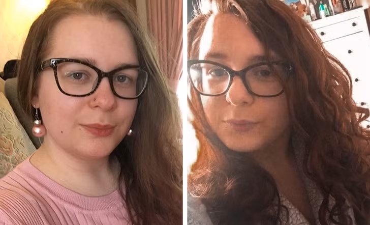 Tạo mặt nạ tóc với trứng và sữa chua Hy Lạp: Trứng rất giàu protein, biotin và vitamin B12 rất cần thiết để tăng cường mọc tóc. Lấy một ít trứng và trộn chúng với sữa chua Hy Lạp, thoa hỗn hợp lên tóc và để yên trong khoảng một giờ. Sau đó, gội đầu và xem kết quả.