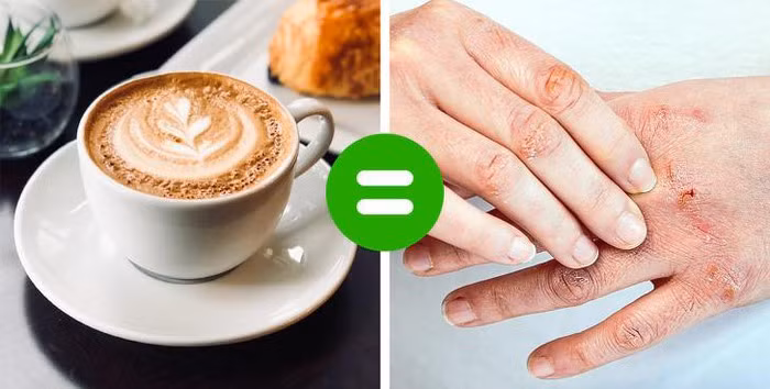 Cà phê và đồ uống chứa caffein khiến da bạn bị khô: Caffeine là một chất lợi tiểu, làm cho bạn bài tiết chất lỏng và tạo ra sự thiếu độ ẩm trong cơ thể. Điều này làm cho làn da của bạn khô và dễ vỡ.