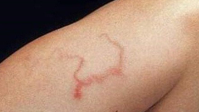 Thu rau mua dong sieu bo mau nhung coi chung nguy co nhiem san-Hinh-3