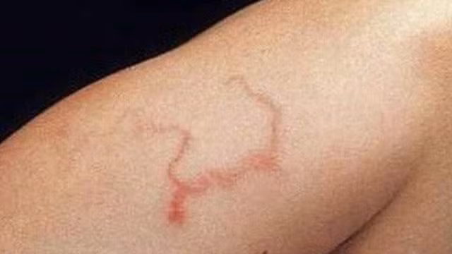 Thu rau mua dong sieu bo mau nhung coi chung nguy co nhiem san-Hinh-3