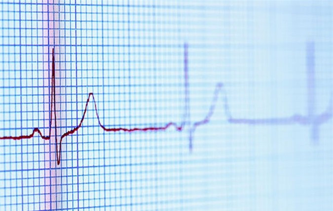 Tụt huyết áp: Trong một số trường hợp, dị ứng thức ăn có thể gây ra các dấu hiệu đe dọa tính mạng như làm khó thở, tụt huyết áp nghiêm trọng, chóng mặt, choáng hoặc bất tỉnh.