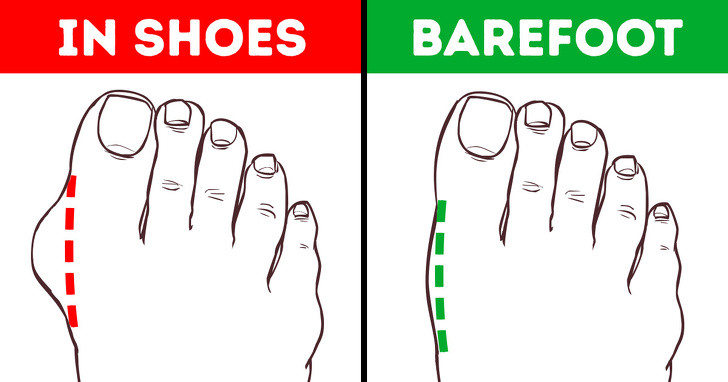 Giảm viêm và sưng chân: Để tránh viêm sưng chân, bạn nên đi chân đất để có thể tăng cường cơ bắp chân, cho phép bàn chân và ngón chân ở vị trí tự nhiên.