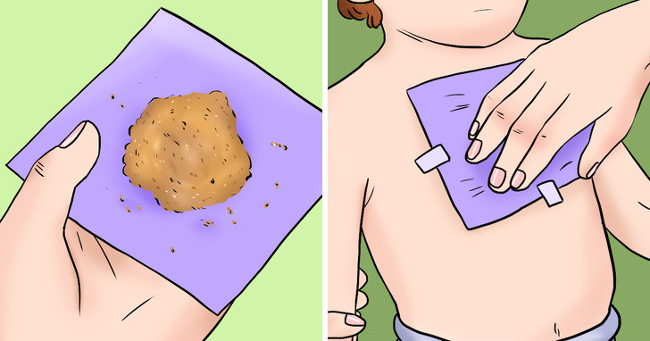 Miếng dán gừng: Phương pháp này khá dễ thực hiện bởi gừng luôn có sẵn trong căn bếp mỗi gia đình. Bạn cần kết hợp một chút bột mì, mật ong và dầu ô liu, với một muỗng canh gừng xay (hoặc bột gừng). Cho một ít hỗn hợp vào khăn ăn và đắp nó lên ngực trẻ rồi cố định bằng băng dính. Áp dụng khoảng 3 giờ trước khi đi ngủ.