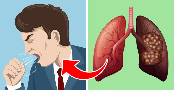 5 dau hieu bao dong phoi ban dang co van de-Hinh-2